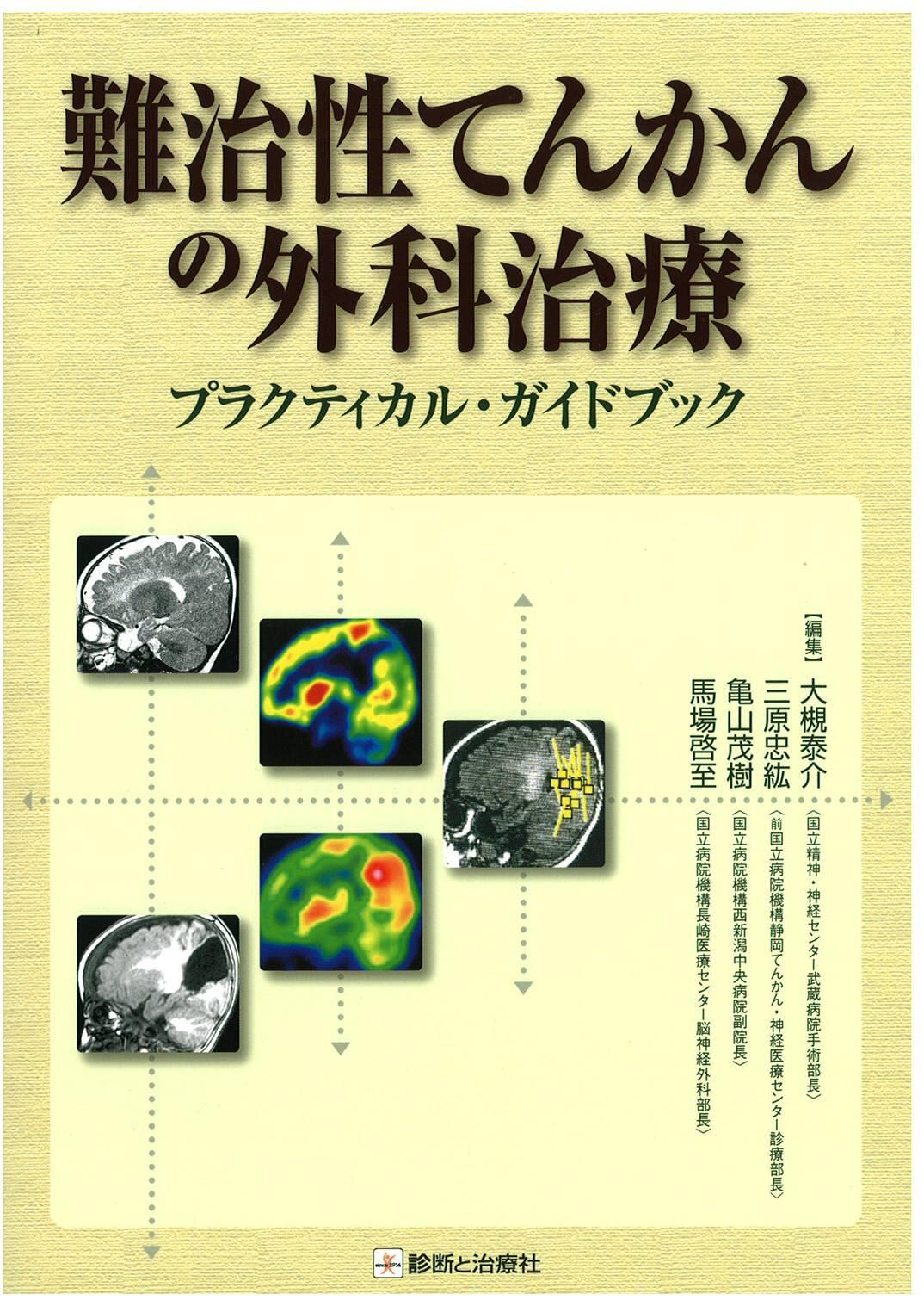難治性てんかんの外科治療 公益社団法人 日本てんかん協会 難治性てんかんの外科治療 公益社団法人 日本てんかん協会